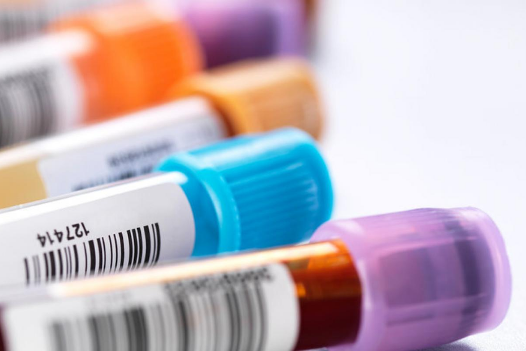 Exames de sangue: quanto custa fazer os exames de rotina?