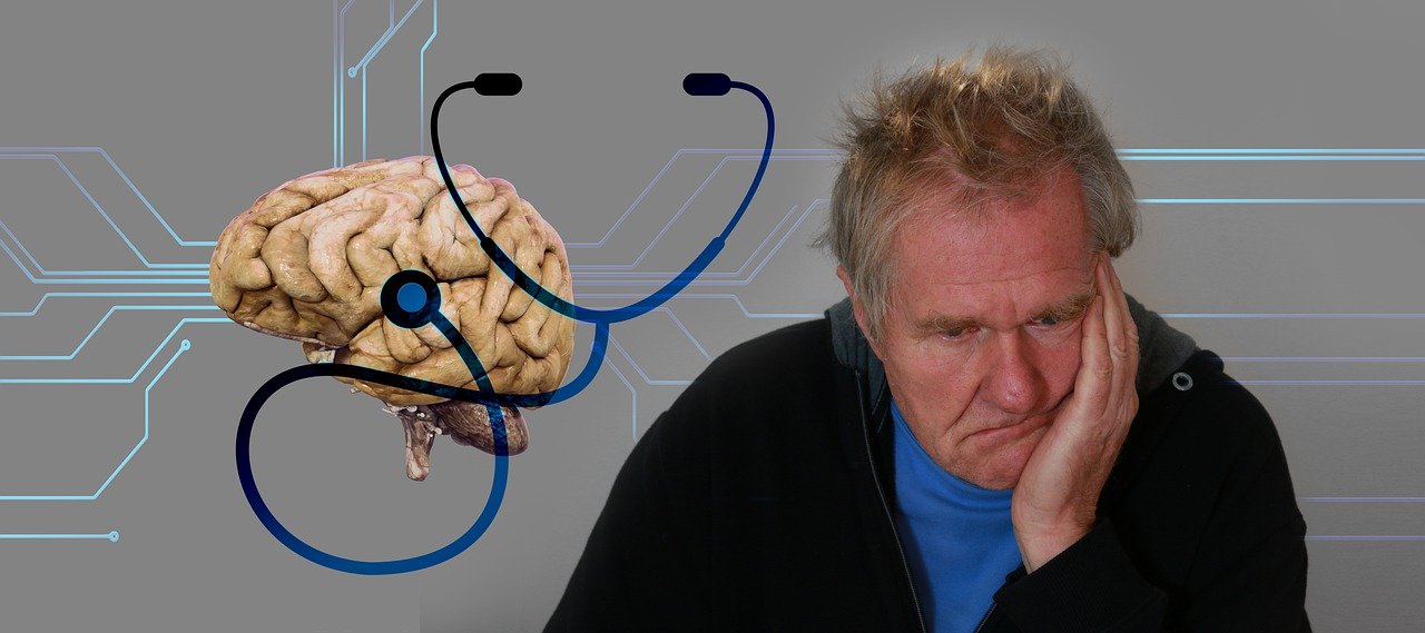 Alzheimer: o que é e seus sintomas